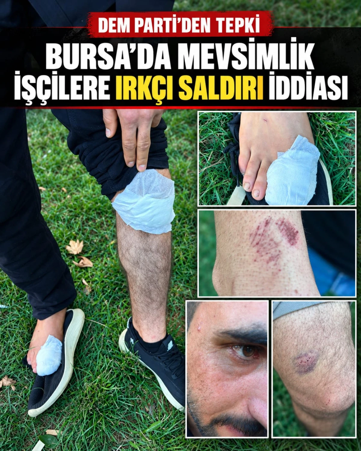 DEM Parti&rsquo;den Bursa&rsquo;daki Irk&ccedil;ı Saldırı İddiasına Tepki