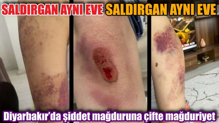 Şiddet faili erkeğe kadının yaşadığı evde ev hapsi!